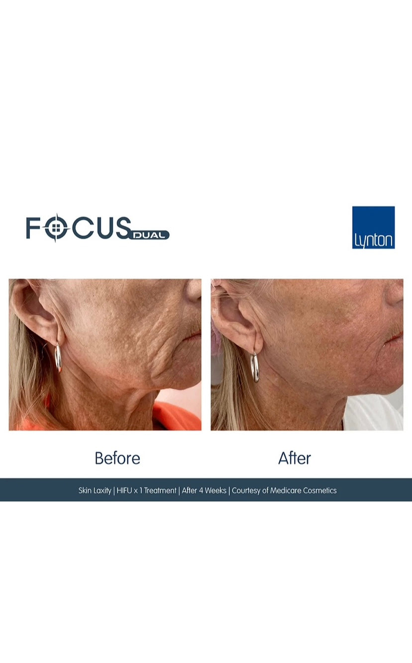 Focus Dual