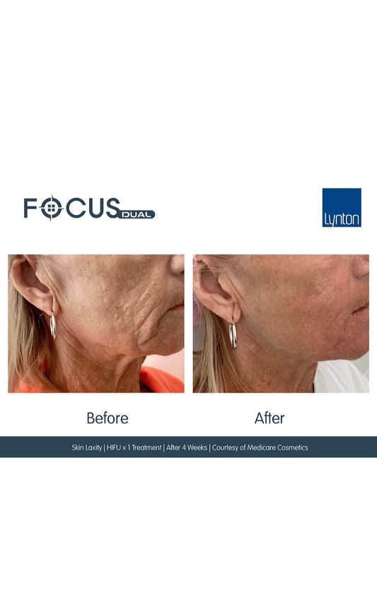Focus Dual