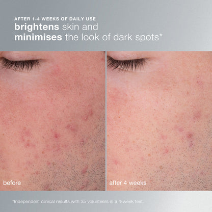 Daily Microfoliant Exfoliator