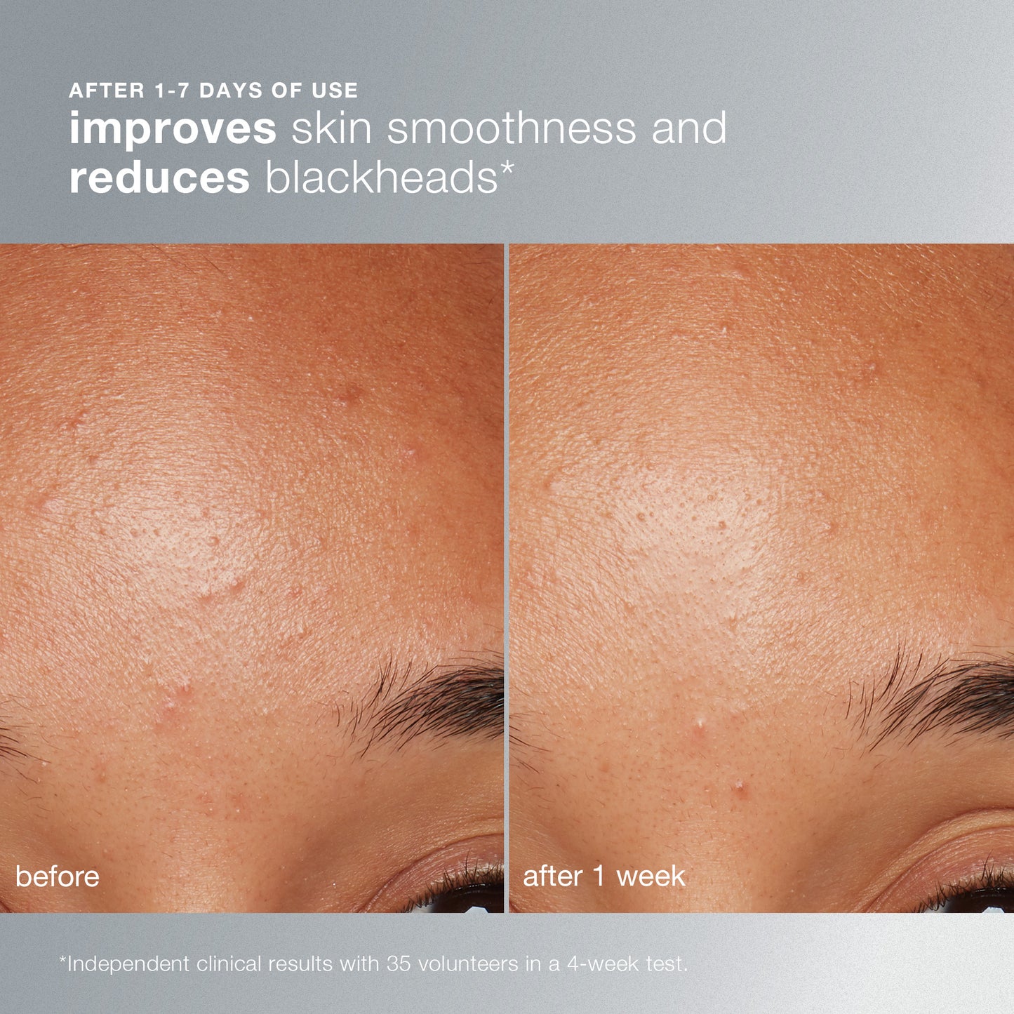 Daily Microfoliant Exfoliator Refill